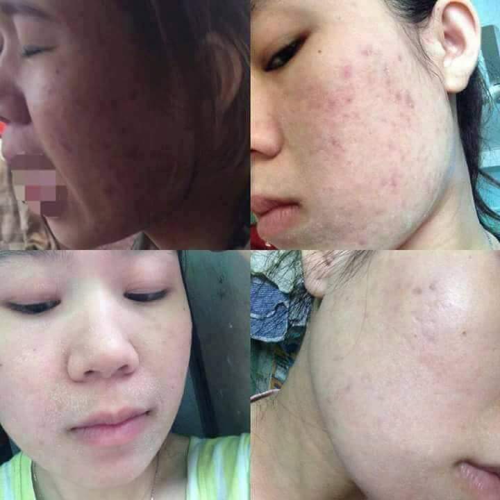 Kem đông y tái tạo da handmade