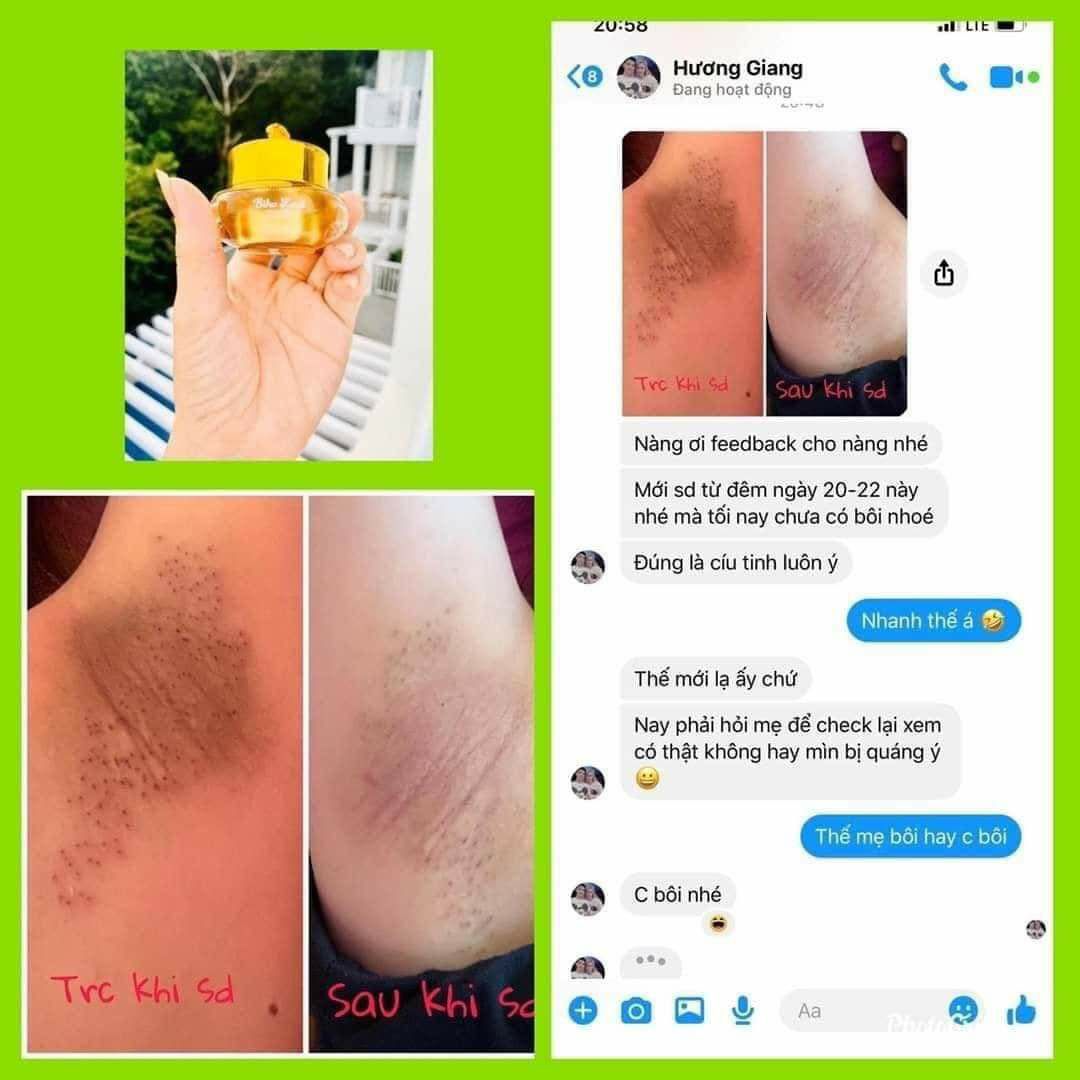 [HÀNG CHÍNH HÃNG] Siêu Dưỡng Thâm 5s Biho ladi
