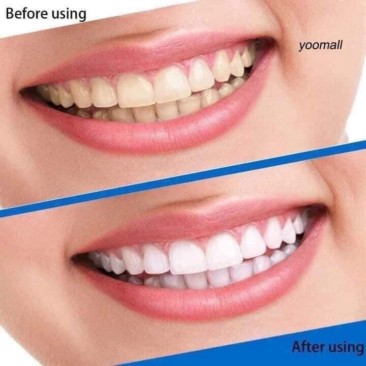 Miếng dán trắng răng 3D White Teeth Whitening Strips, miếng dán trắng răng 5d miếng dán trắng răng chính hãng, miếng dán trắng răng crest 3d white Miếng dán trắng răng 3D White Teeth Whitening Strips hỗ trợ làm trắng răng hiệu quả