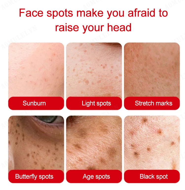 aomulei spot lightening cream moisturizing face cream