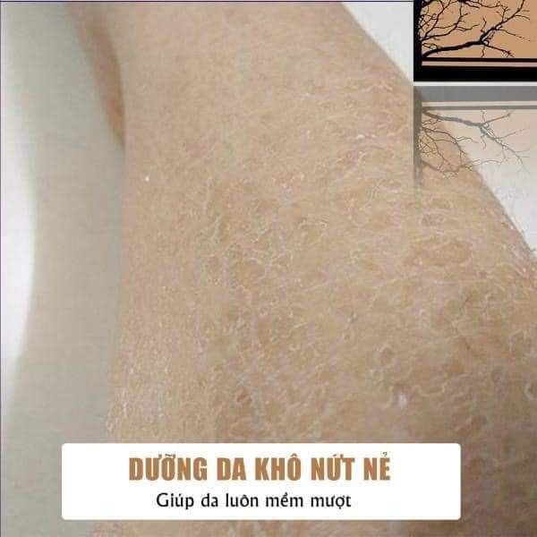 Mỡ Trăn N'store