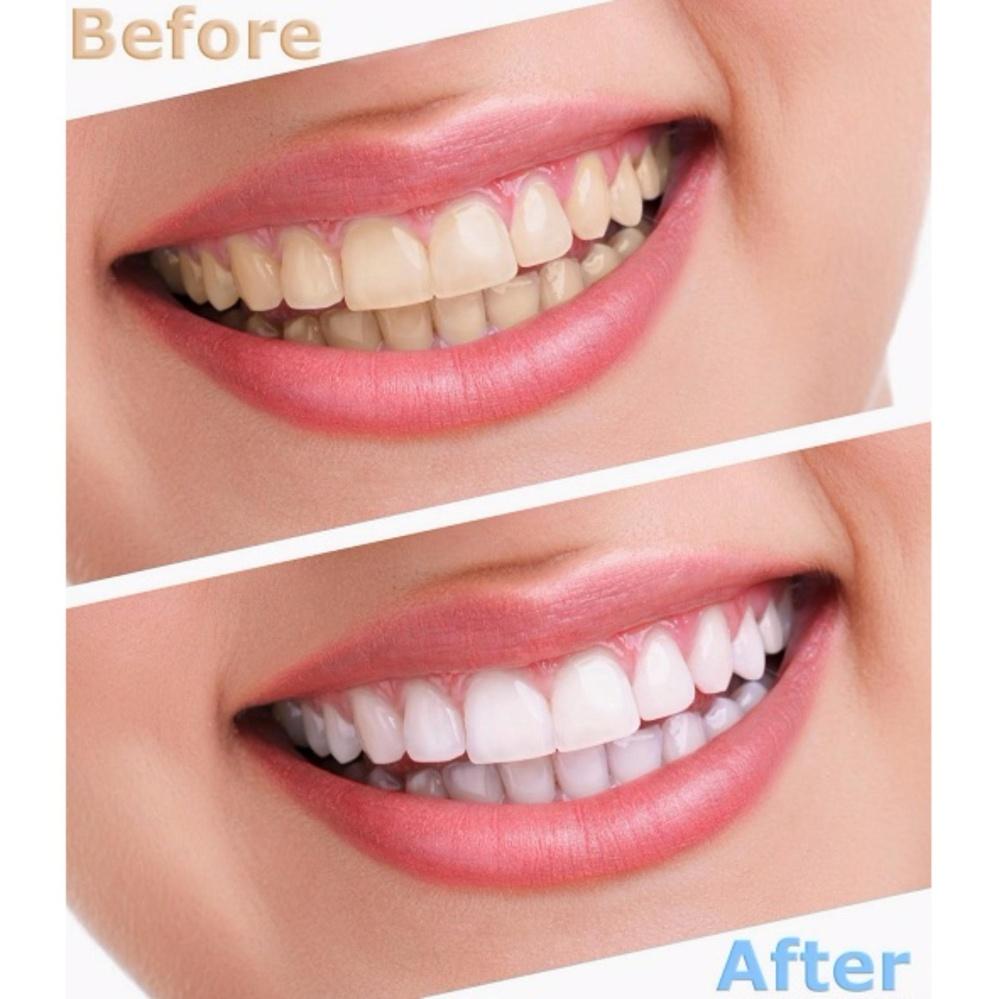 Kem Đánh Răng Colgate Total Advanced Whitening 181g - Mỹ