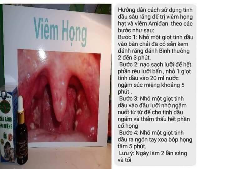 Tinh dầu răng miệng DẠ THẢO LIÊN