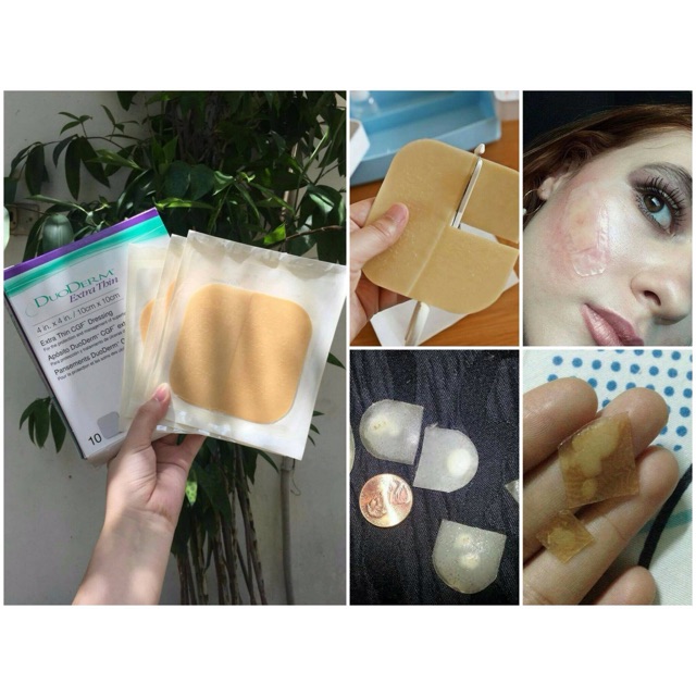Miếng dán mụn Duoderm Extra Thin 10 x 10cm