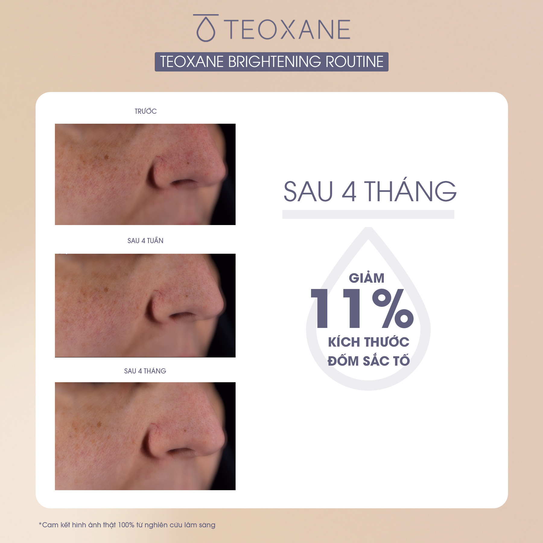 Combo RHA Vit C Serum + Kem chống Nắng Advanced Perfecting Shield SPF 50+