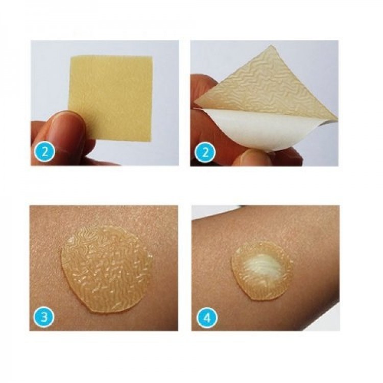 1 Miếng Dán Nhanh Xẹp Mụn DuoDerm Extra Thin