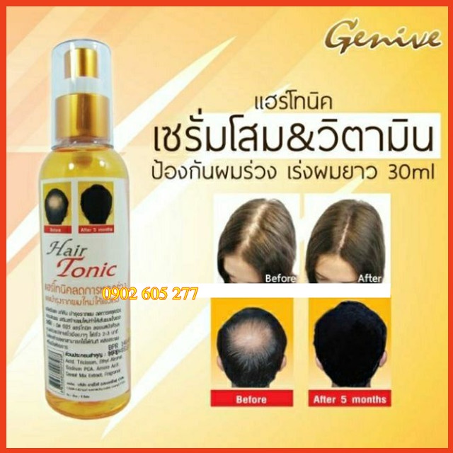 Xịt mọc tóc Genive Hair Tonic Thái Lan