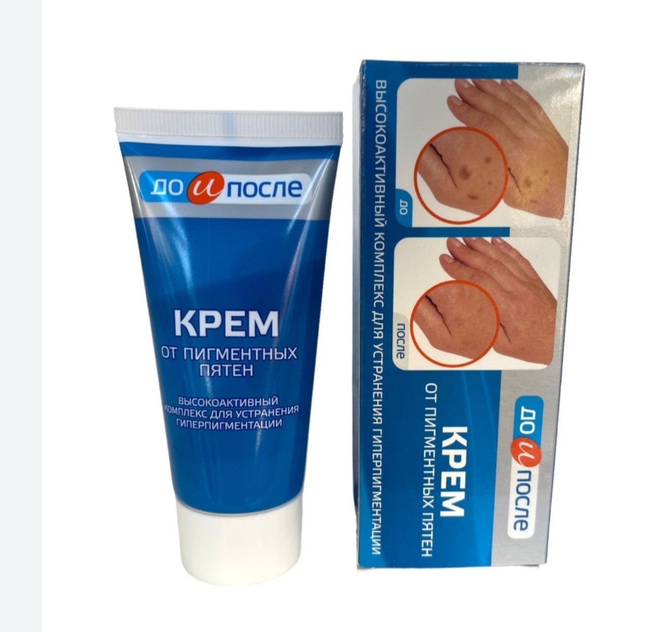 Kem giảm đồi mồi tay Nga