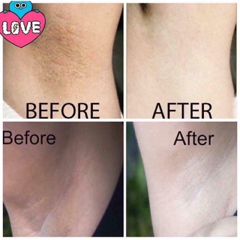 [ HOT] Xà Phòng Belo Extra Moisture trắng da dưỡng ẩm (65Gr)