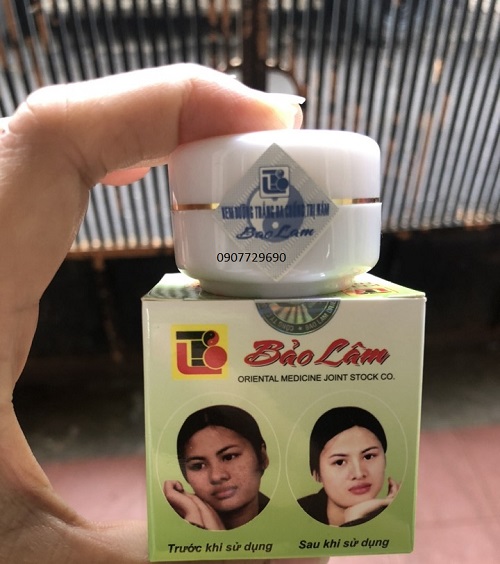 Kem trắng da chống nám - Bảo Lâm
