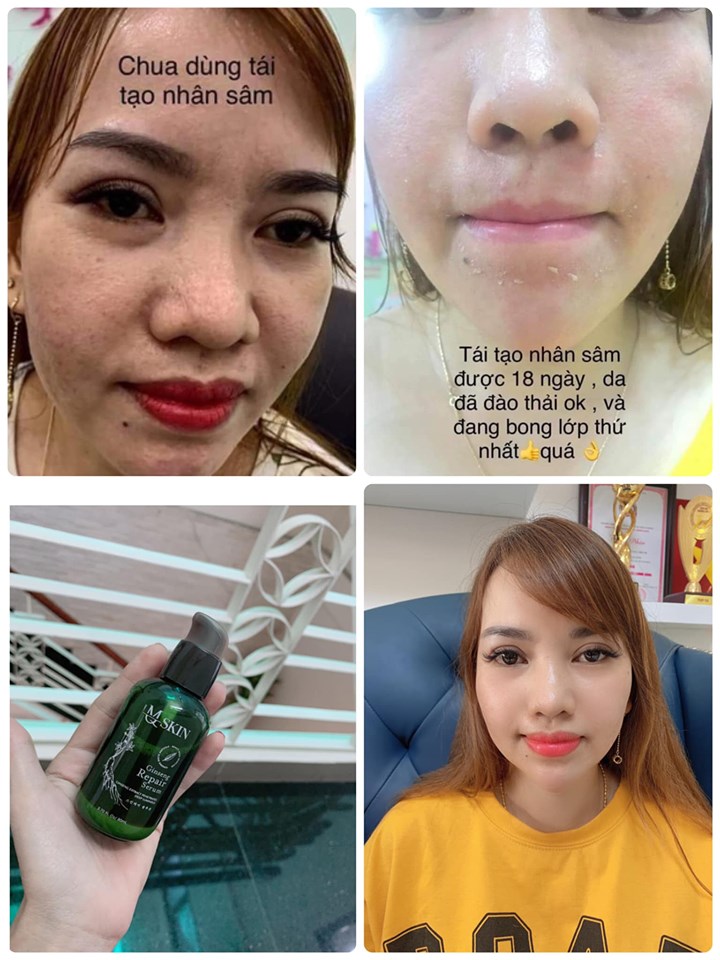 [HCM]SERUM THAY DA NHÂN SÂM MQ SKIN