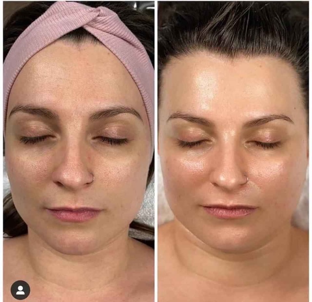 Serum Vitamin C Esthemax sáng da 100ml