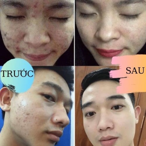 Bột đắp mặt thảo DR CARE PRO