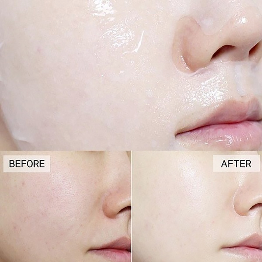 Mặt nạ giấy dành cho da mụn Some by mi tea tree calming 25gr