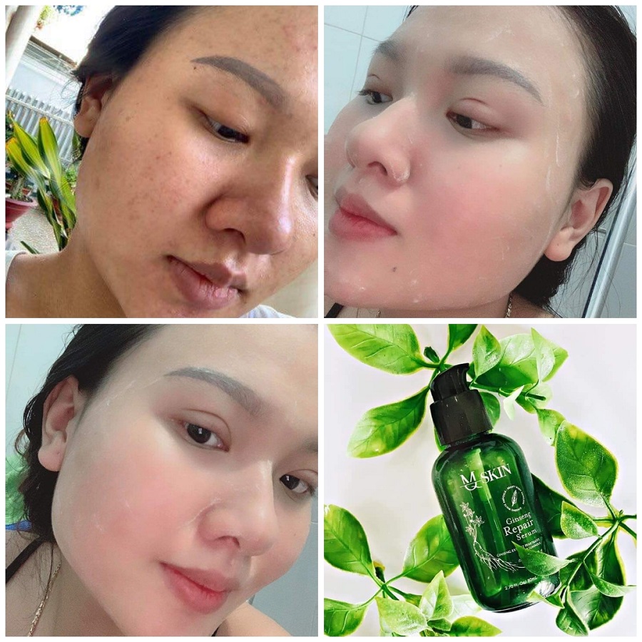 [HCM]Serum tái tạo da MQ Skin