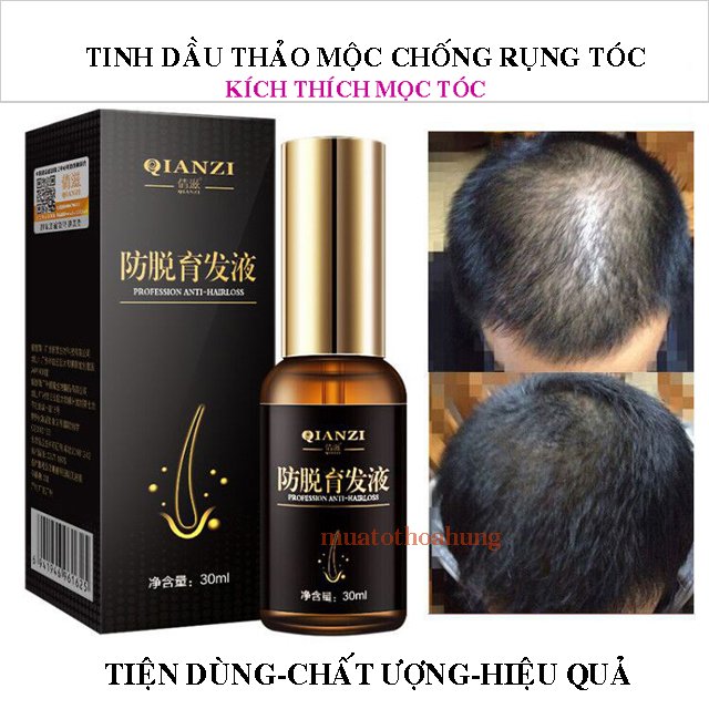 Tinh Dầu Thảo Mộc Chống Rụng Tóc Kích Thích Mọc Tóc Từ Nhân Sâm 30ml