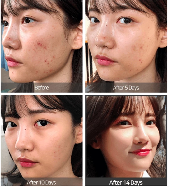 Tinh Chất Some By Mi AHA-BHA-PHA 30 Days Miracle Serum 50ml