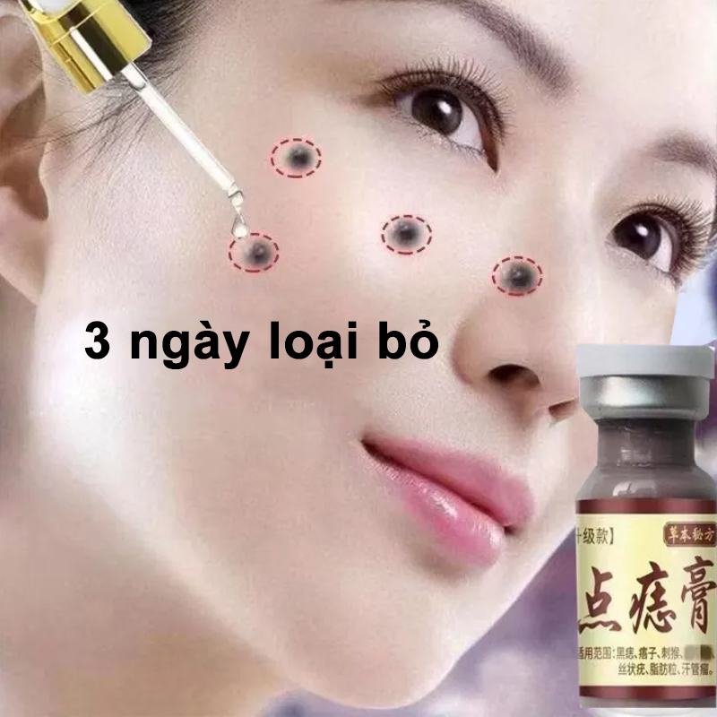 Kem tẩy nốt ruồi mụn cóc mụn thịt tàn nhang sẹo lồi thần thánh giúp bạn xóa đi khuyết điểm toàn thân hiệu quả nhanh chóng trong 7 ngày 5g,không gây đau rát, hiệu quả nhanh chóng