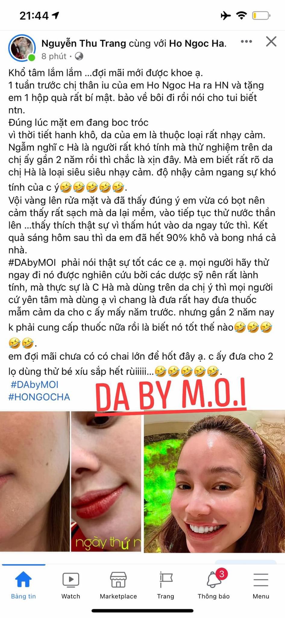 SỮA RỬA MẶT VÀ TONER DA BY MOI