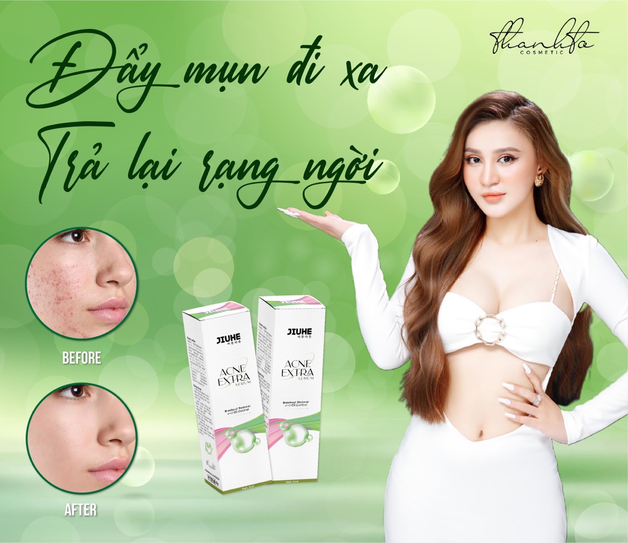 Combo serum jiuhe mụn acne extra vaf kem face jiuhe thanh tô