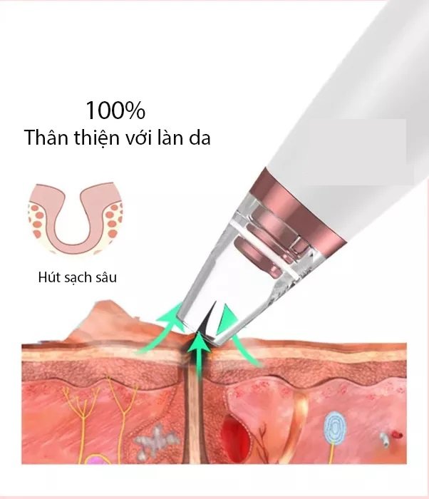 Máy hút mụn đầu đen mini cầm tay