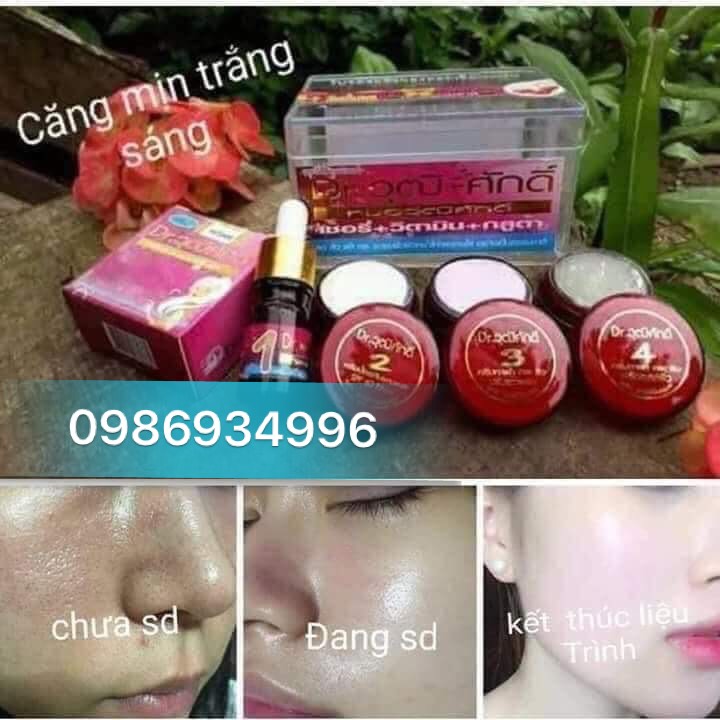 [Xả Kho] cherry đỏ  thái lan