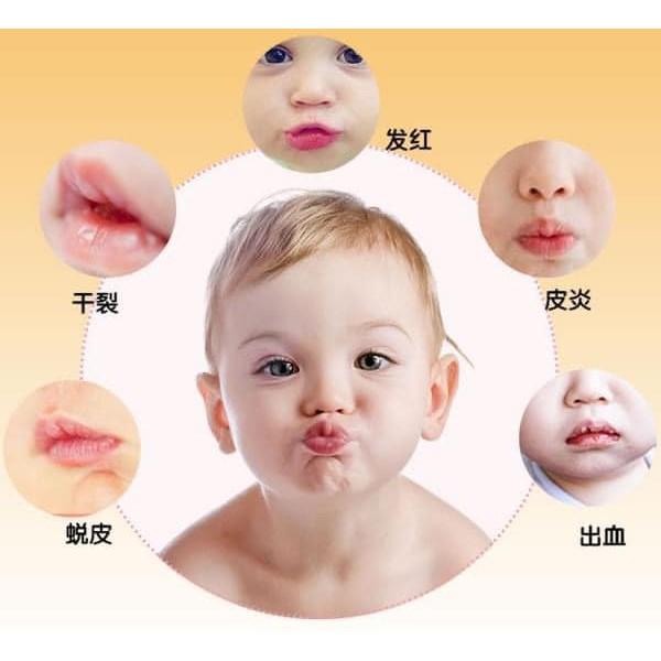 Son Dưỡng Môi Cho Bé Wakodo Nhật Bản