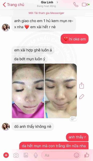 Kem Mụn Mờ Thâm Giảm Nhờn Oshirma 10GR
