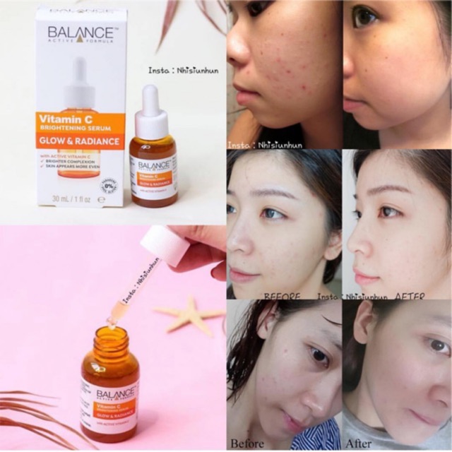 SERUM BLANCE BLANCE VITAMIN C