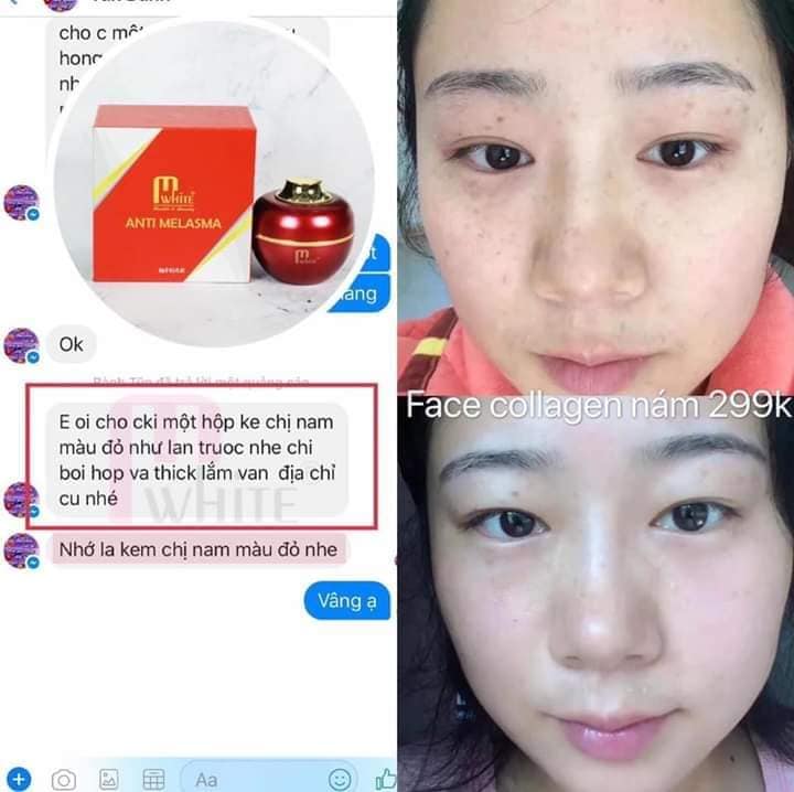 [HCM]Kem face collagen dành cho da nám Mwhite 30gr ( mẫu mới )