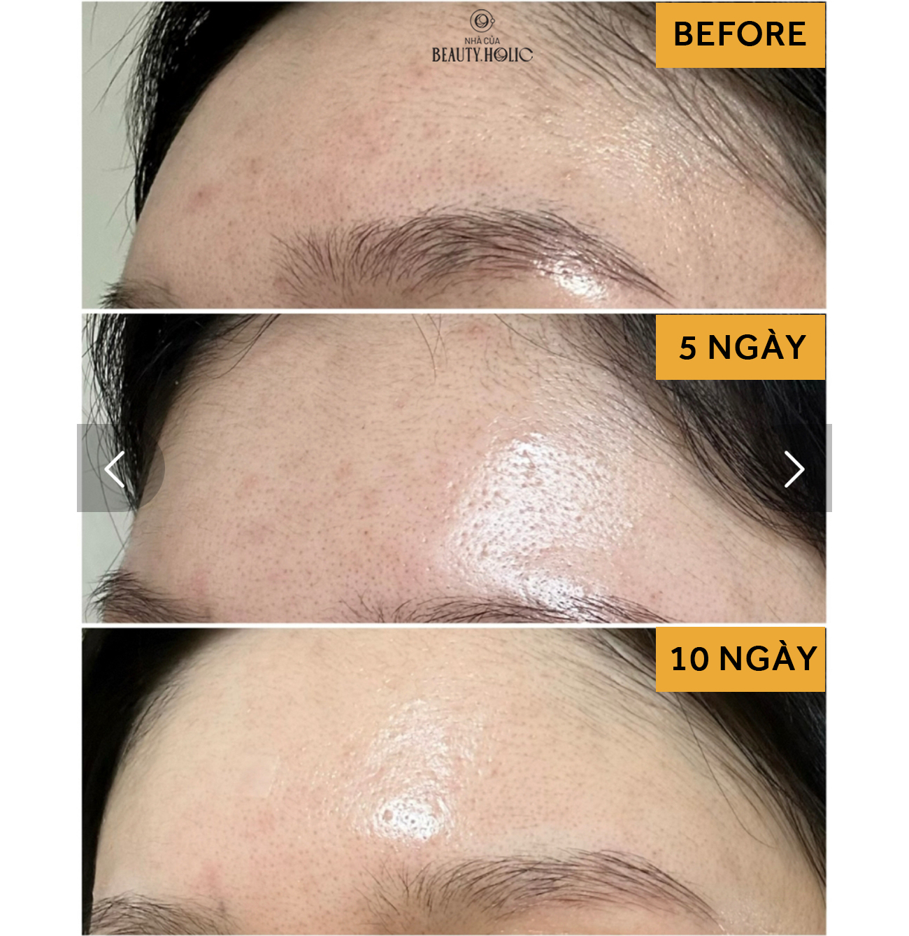 [Nhacuabeautyholic] Bột rửa mặt NEEDLY MILD ENZYME CLEANSING POWDER