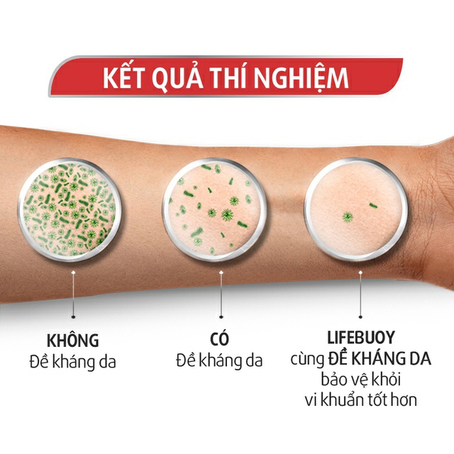 Sữa tắm Lifebuoy / Lifebouy túi 800g