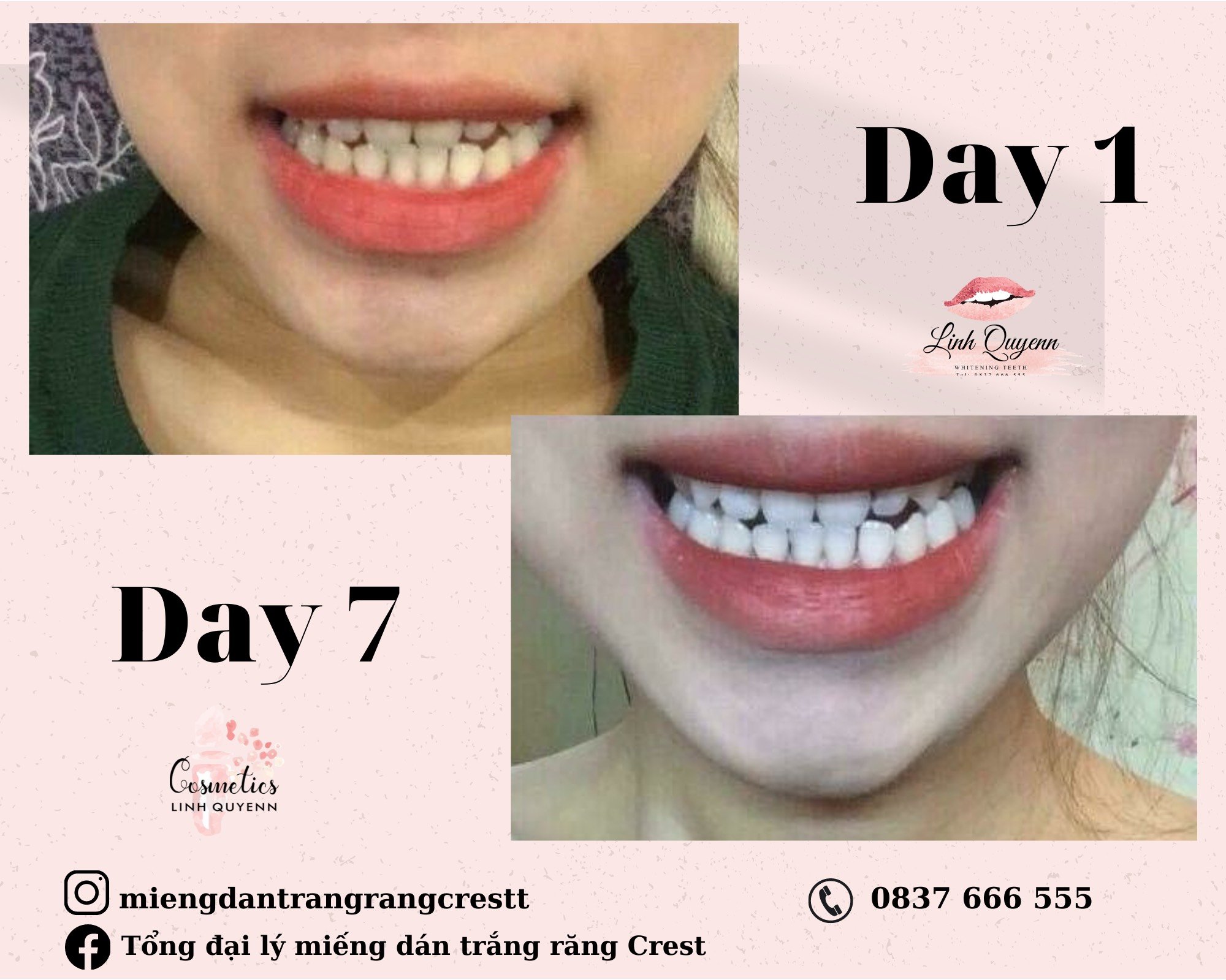 Kem Đánh Răng Crest Gum Detoxify Siêu Trắng 147gr