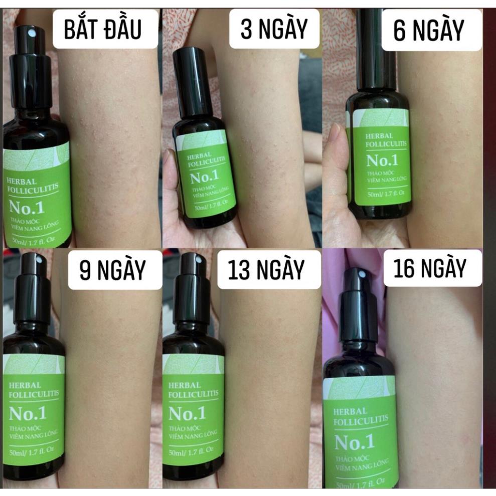 Combo 2 Xịt Thảo Mộc VNL MEE NATURAL 50ml