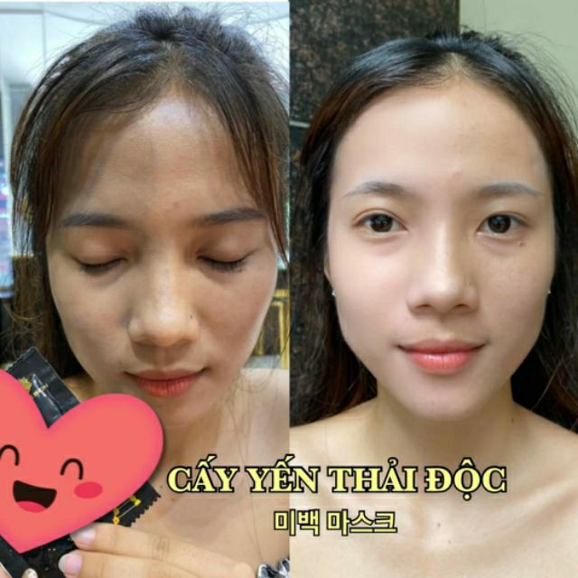 Siêu phẩm Cấy trắng - Thải độc LUXURY GOLDEN MASK