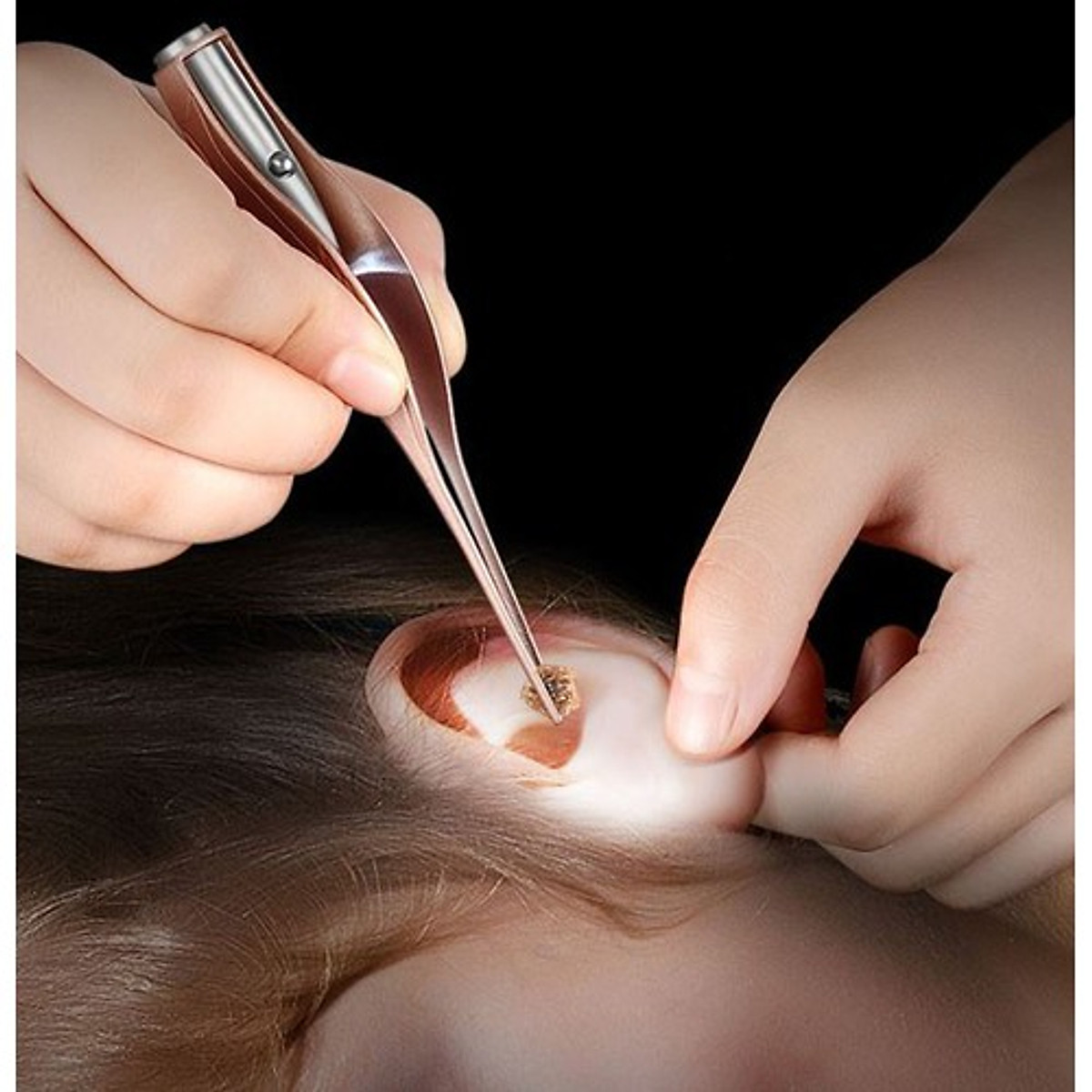 Bộ dụng cụ gắp ráy tai thông minh có đèn