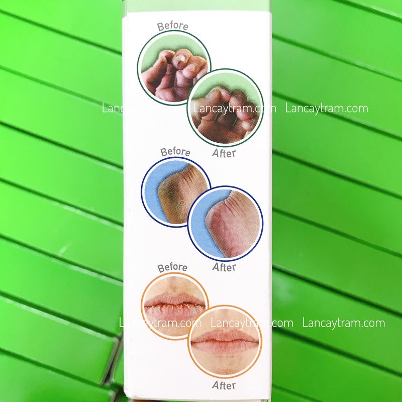 SET 3 DƯỠNG O'KEEFFE'S MÔI + TAY + CHÂN SKINCARE WORKING