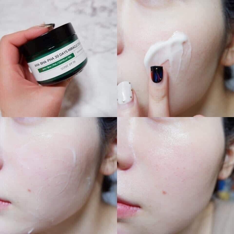 Kem dưỡng trị thâm, mụn AHA – BHA – PHA Miracle 30 Days SOME BY MI
