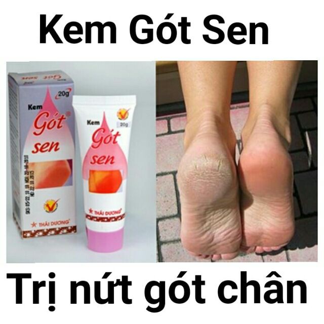 [HCM]Kem Gót Sen chống nứt nẻ gót chân