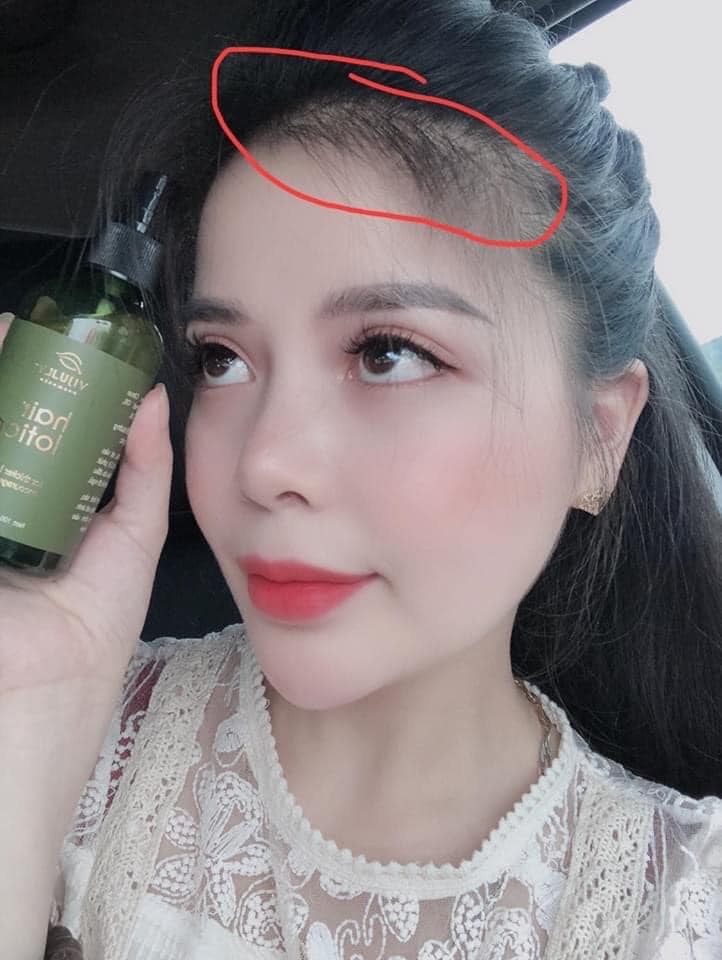[ Vi Jully ] Combo 5 Chai Tinh Dầu Bưởi Vi Jully Kích Mọc Tóc - Làm Dài Tóc Nhanh