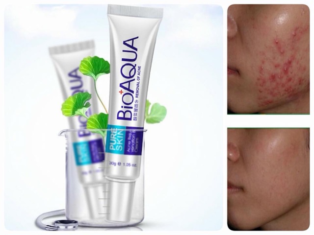 [HCM]Kem  Mụn Pure Skin Bioaqua