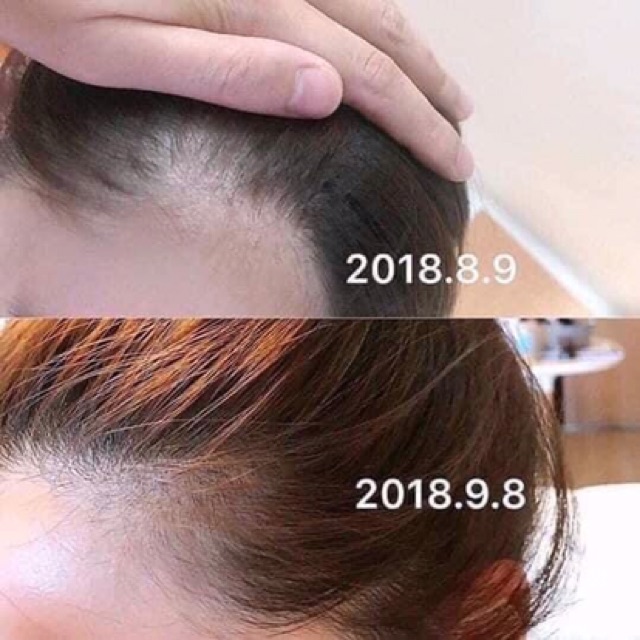 Tinh Chất Bôi Kích Thích Mọc Tóc Thảo Dược SATO 30ml