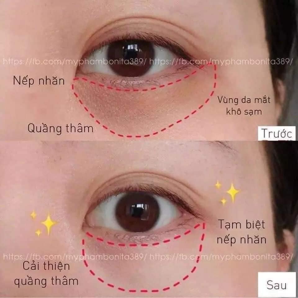 💚💚MẶT NẠ MẮT BIO.AQUA 60 MIẾNG 💚💚