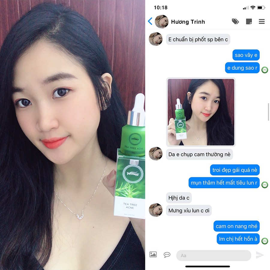Serum Tràm Trà Venus 15ml sạch mụn & mờ thâm trắng da