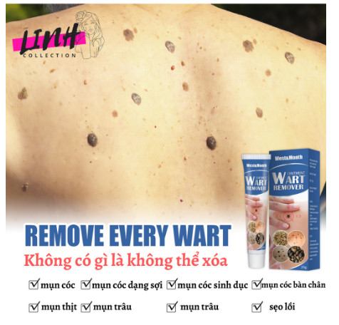 {ĐÁNH BẬT} Mụn Cóc, Mụn Thịt Remove Every Warts