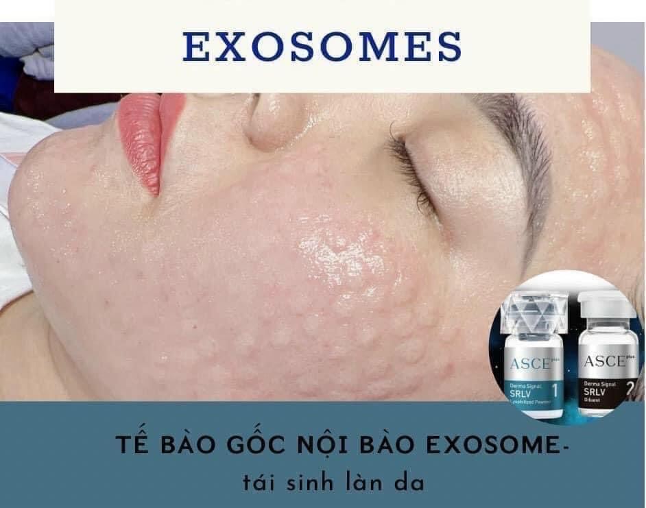 Tinh chất căng bóng da tiêm meso (EXOSOME) ASCE plus Cho Trẻ Hoá Da - 1 cặp