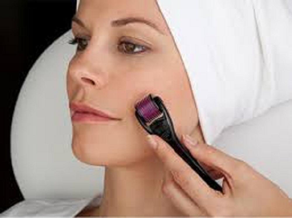 [HCM]Dụng cụ lăn kim trị mụn y khoa