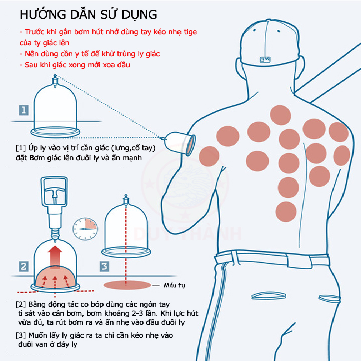 Bộ Giác Hơi Không Dùng Lửa YGH05 hộp giấy siêu tiết kiệm 6 ly giác