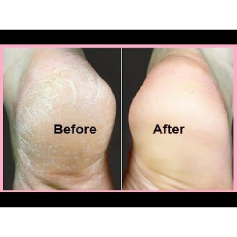 ĐÁ BỌT CHÀ GÓT CHÂN KÈM BÀN CHẢI CHÀ MÓNG nội địa Nhật Bản