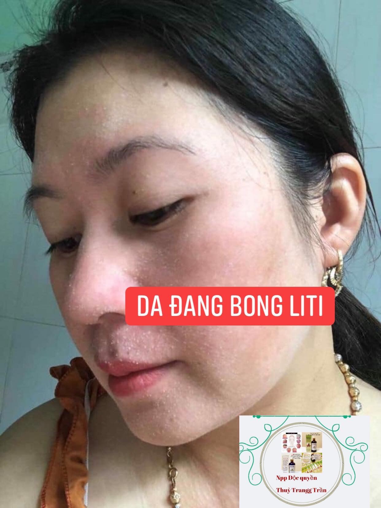 Tái Tạo Da (50ml)